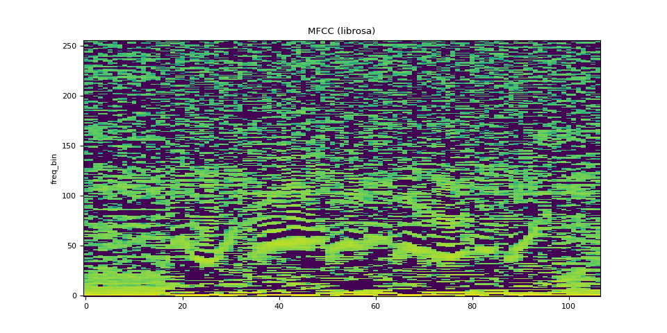 Spectrogram (db)
