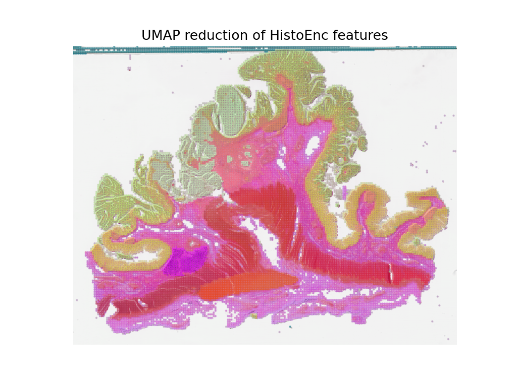 UMAP reduction of HistoEnc features